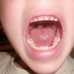 Как отбелить зубы дома