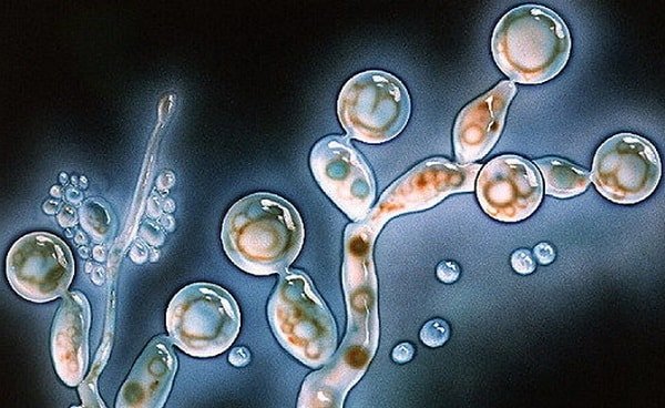 Грибковые инфекции - кандида под микроскопом 