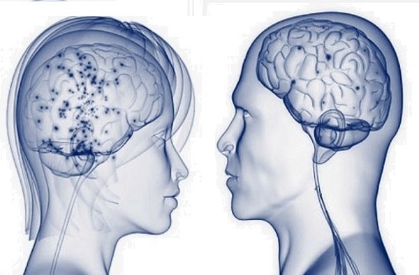 Различия в строении головного мозга женщин и мужчин 