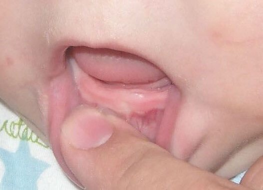 Первый зубик малыша 