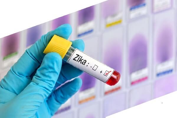 Вирус Зика – симптомы, диагностика и лечение, профилактика. 